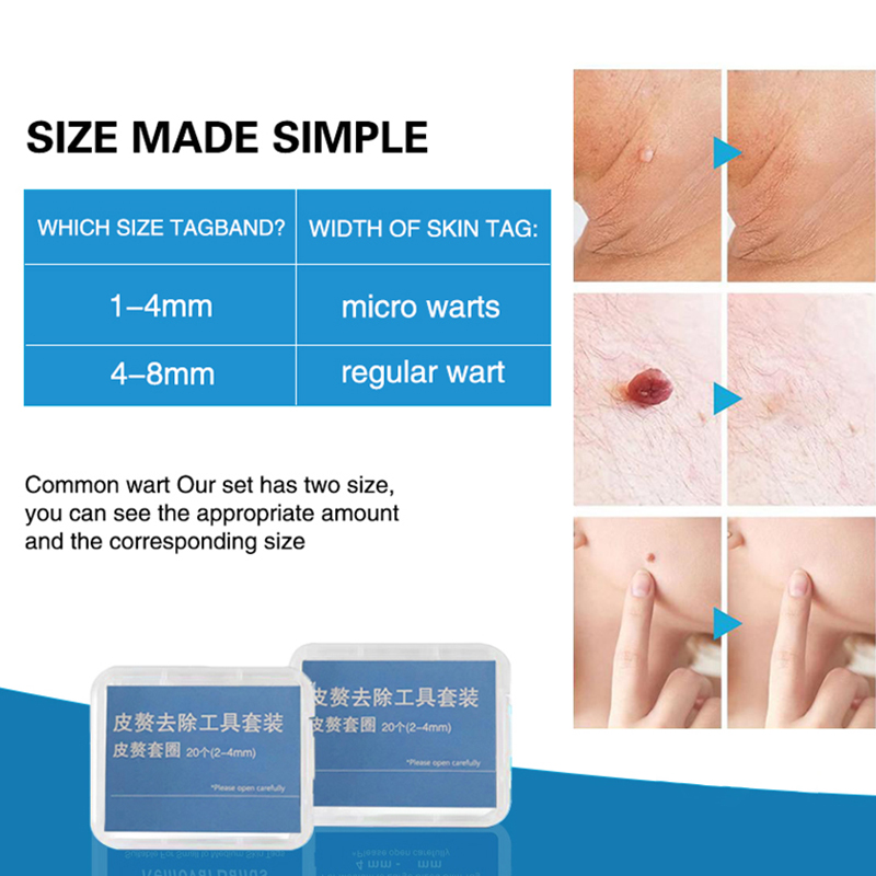 ชุดกำจัดไฝ 20 ชิ้น/กล่อง  แบบไ - Electric Gadget บทวิจารณ์และราคา